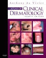 bokomslag Atlas of Clinical Dermatology