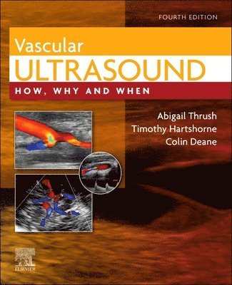 Vascular Ultrasound 1