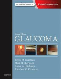 bokomslag Glaucoma