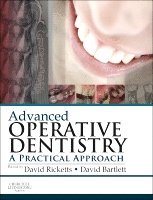 Advanced Operative Dentistry 1