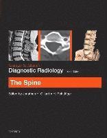 Jonathan H Gillard, H. Rolf Jager, Jonathan H. Gillard, H Rolf Jager - Grainger & Allison's Diagnostic Radiology: The Spine, Häftad