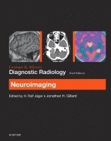 H. Rolf Jager, Jonathan H. Gillard - Grainger & Allison's Diagnostic Radiology: Neuroimaging, Häftad