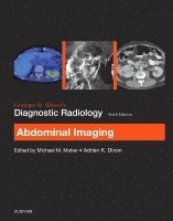 Michael Maher, Adrian K. Dixon - Grainger & Allison's Diagnostic Radiology: Abdominal Imaging, Häftad