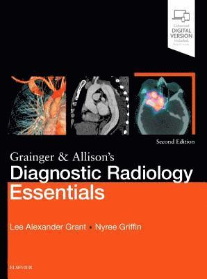 Lee A. Grant, Nyree Griffin - Grainger & Allison's Diagnostic Radiology Essentials, Inbunden