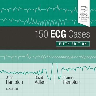 John Hampton, David Adlam, Joanna Hampton - 150 ECG Cases, Häftad