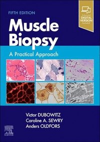 bokomslag Muscle Biopsy