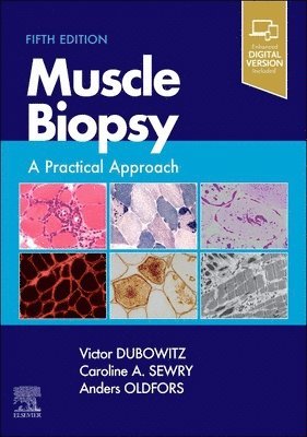 Muscle Biopsy 1
