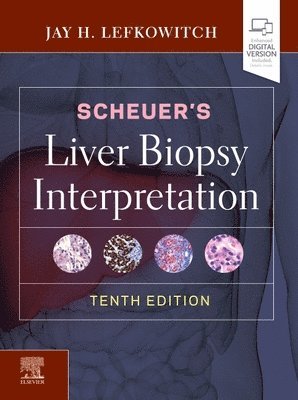 bokomslag Scheuer's Liver Biopsy Interpretation