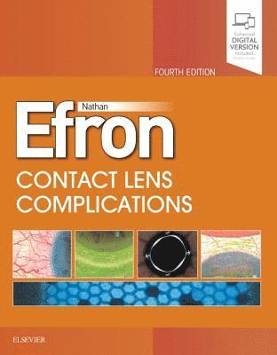 bokomslag Contact Lens  Complications