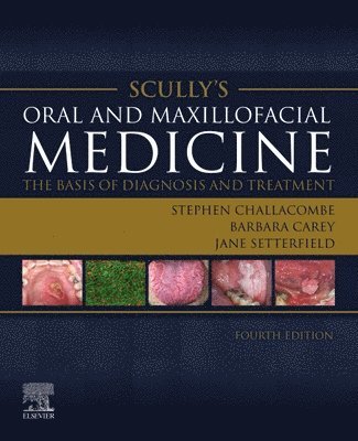 Stephen J. Challacombe, Barbara Carey, Jane Setterfield, UK) Challacombe, Stephen J. (Martin Rushton Professor of Oral Medicine, Centre for Host-Microbiome Interactions, King's College London, Guy's Hospital, London, UK) Carey, Barbara, MB, BCh, BAO, BDS, NUI, BA, FDS (OM), RCSI, FFDRCSI (Oral Medicine), FHEA (Consultant in Oral Medicine, Guy's & St Thomas's NHS Foundation Trust, London, MD Setterfield, Jane, MBBS, BDS, DCH, DRCOG, SFHEA, FRCP - Scully's Oral and Maxillofacial Medicine: The Basis of Diagnosis and Treatment, Häftad
