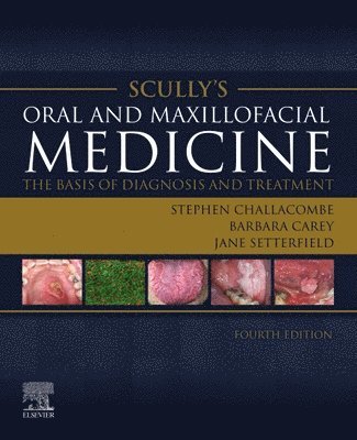 Scully's Oral and Maxillofacial Medicine: The Basis of Diagnosis and Treatment 1