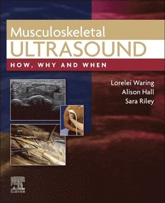 Lorelei Waring, Alison Hall, Sara Riley - Musculoskeletal Ultrasound, Inbunden