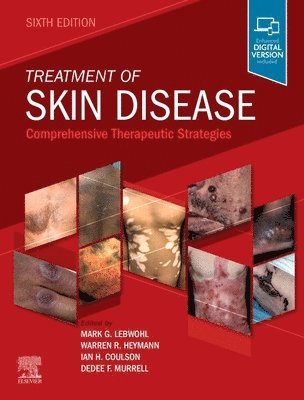 bokomslag Treatment of Skin Disease