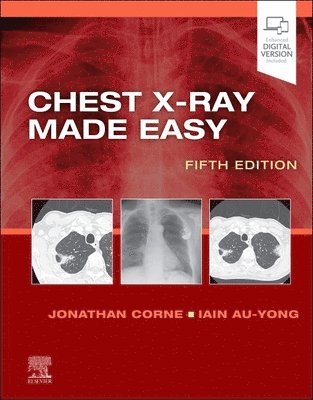 bokomslag Chest X-Ray Made Easy