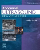 Nicola Davidson - Abdominal Ultrasound, Inbunden