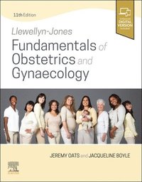 bokomslag Llewellyn-Jones Fundamentals of Obstetrics and Gynaecology