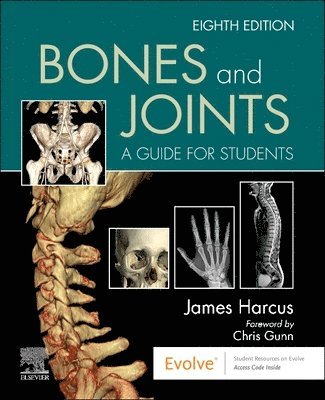 James Harcus, UK) Harcus, James (Lecturer in Diagnostic Imaging, University of Leeds - Bones and Joints, Häftad