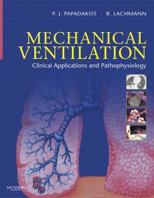 bokomslag Mechanical Ventilation