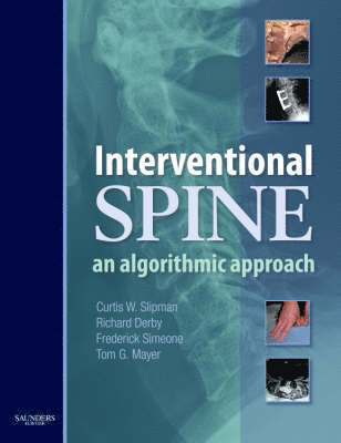 Interventional Spine