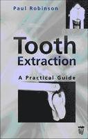 bokomslag Tooth Extraction