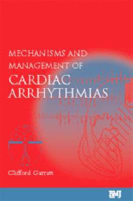 bokomslag Mechanisms and Management of Cardiac Arrhythmias