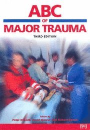 Abc of major trauma