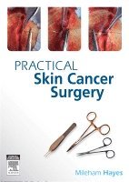Mileham Hayes - Practical Skin Cancer Surgery, Häftad
