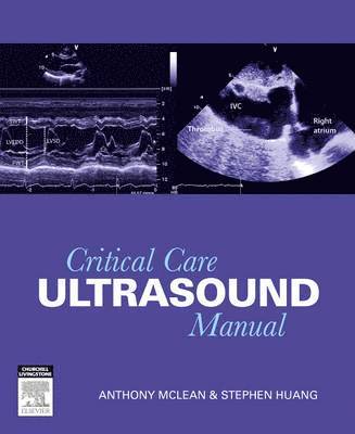 Anthony McLean, Stephen Huang - Critical Care Ultrasound Manual, Häftad