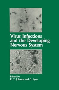 bokomslag Virus Infections and the Developing Nervous System