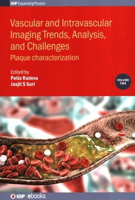 Vascular and Intravaslcular Imaging Trends, Analysis, and Challenges  - Volume 2 1