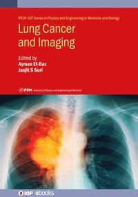 bokomslag Lung Cancer and Imaging