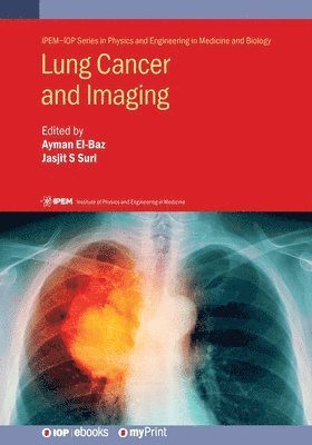 bokomslag Lung Cancer and Imaging