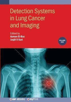Ayman El-Baz, Jasjit S Suri - Detection Systems in Lung Cancer and Imaging, Volume 1, Häftad