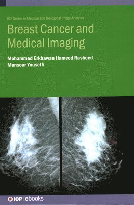 Breast Cancer and Medical Imaging 1