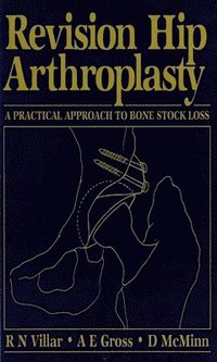 bokomslag Revision Hip Arthroplasty