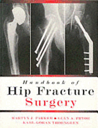 bokomslag Handbook Of Hip Fracture surgery