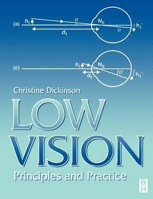 Low Vision 1