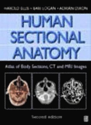 Harold Ellis, Bari M. Logan - Human Sectional Anatomy: Atlas of Body Sections, CT and MRI Images, Inbunden