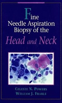 bokomslag Fine Needle Aspiration Biopsy of the Head and Neck