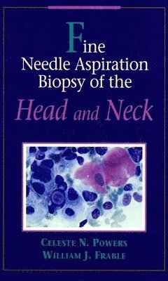 Fine Needle Aspiration Biopsy of the Head and Neck 1