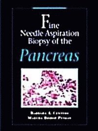 bokomslag Fine Needle Aspiration Biopsy of the Pancreas