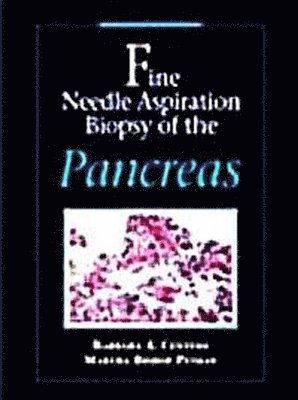 bokomslag Fine Needle Aspiration Biopsy of the Pancreas