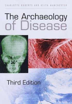 bokomslag Archaeology of Disease