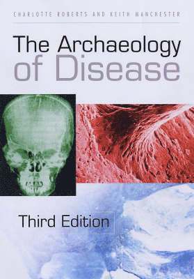 The Archaeology of Disease 1