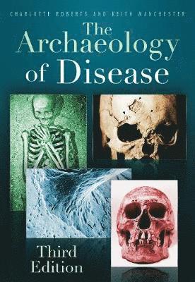 bokomslag The Archaeology of Disease