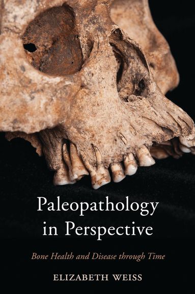 Elizabeth Weiss - Paleopathology in Perspective, Inbunden