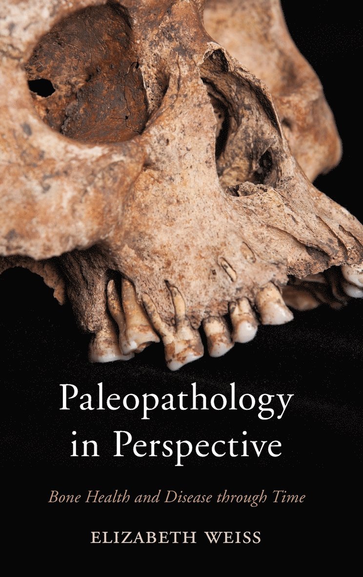 Elizabeth Weiss - Paleopathology in Perspective, Inbunden