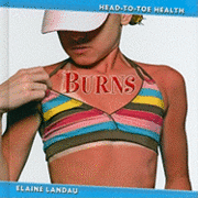 Elaine Landau - Burns, Inbunden