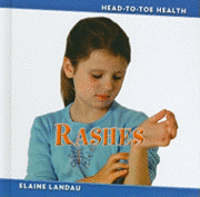 Elaine Landau - Rashes, Inbunden