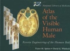 Victor M. Spitzer, David G. Whitlock - National Library of Medicine Atlas of the Visible Human Male: Reverse Engineering of the Human Body: Reverse Engineering of the Human Body, Inbunden